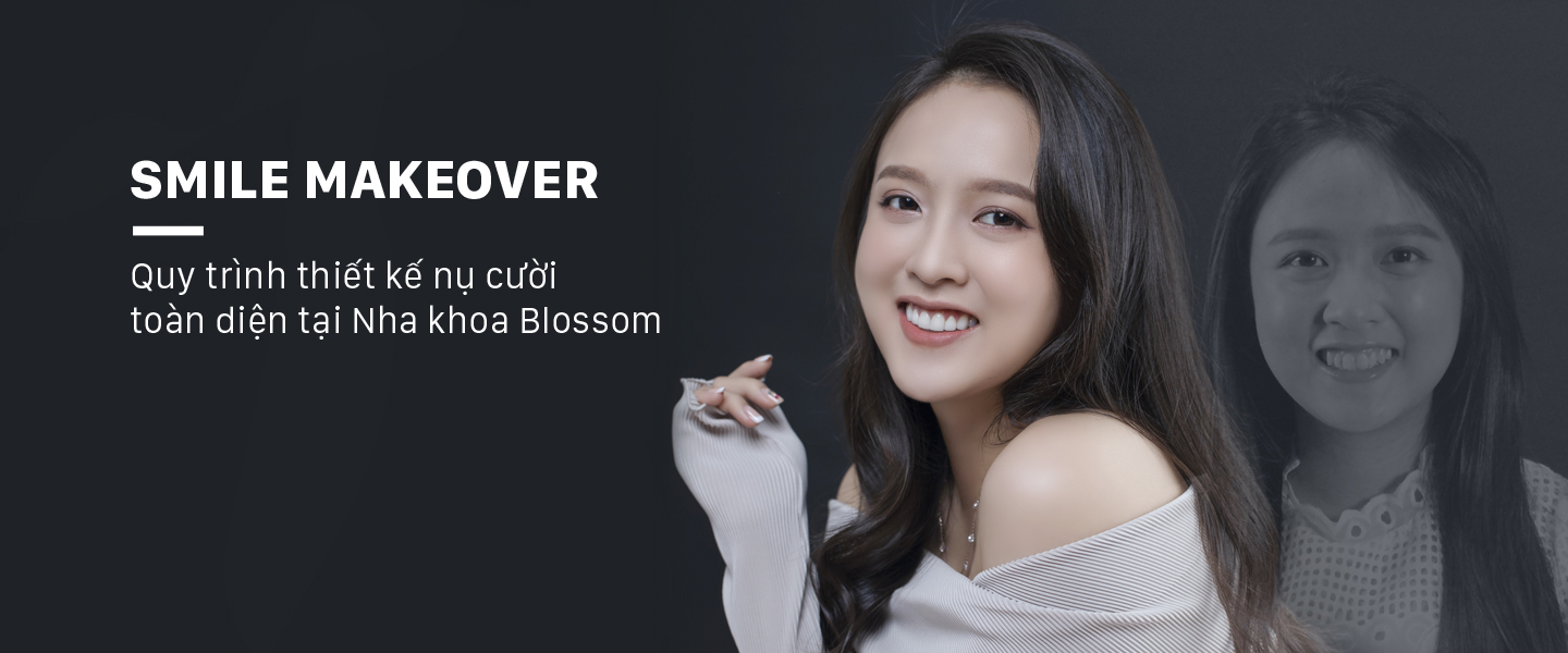Quy trình Smile Makeover blossom clinic Dán sứ Blossom LamiFilm không mài Trồng răng Implant Niềng răng Invisalign
