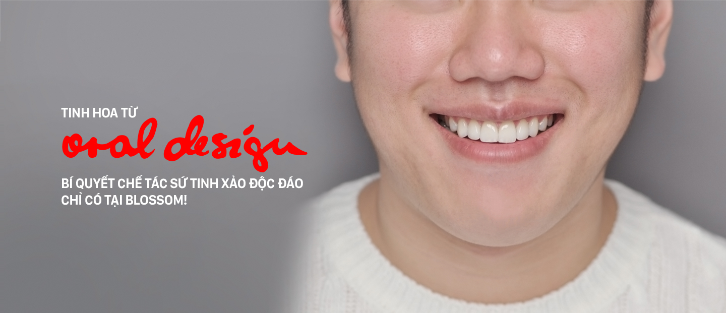 Bí quyết chế tác sứ thủ công và tinh xảo từ Oral Design blossom clinic Dán sứ Blossom LamiFilm không mài Trồng răng Implant Niềng răng Invisalign