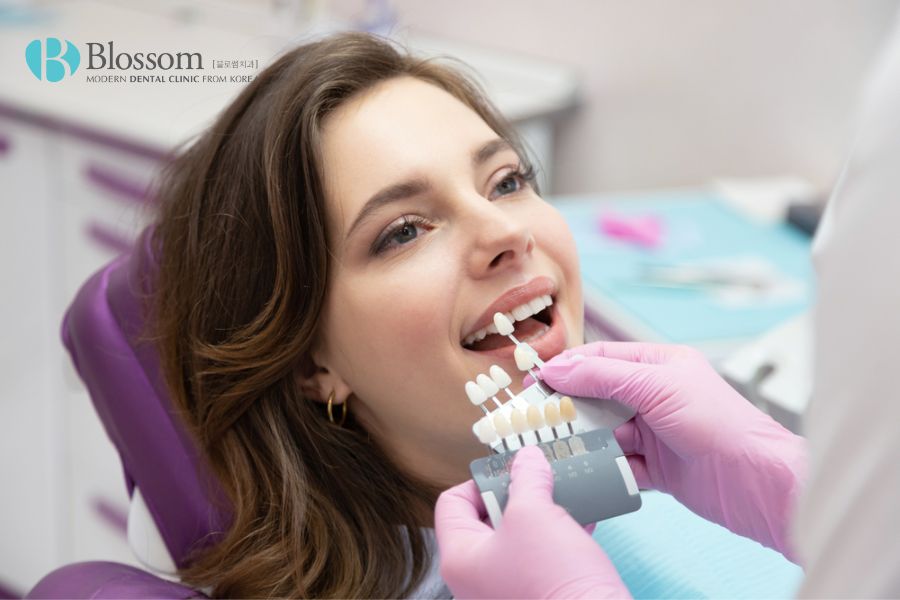 Có thể duy trì mặt dán sứ khoảng 15 - 20 năm khi chăm sóc răng miệng đúng cách
