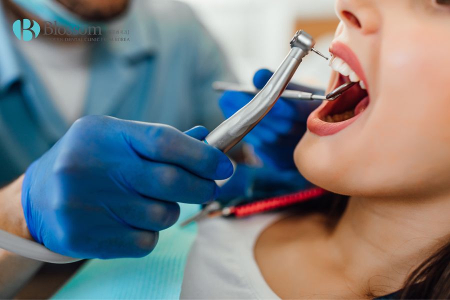 Dán sứ nguyên hàm có thể mang đến cảm giác khó chịu khi cần mài một lúc nhiều răng