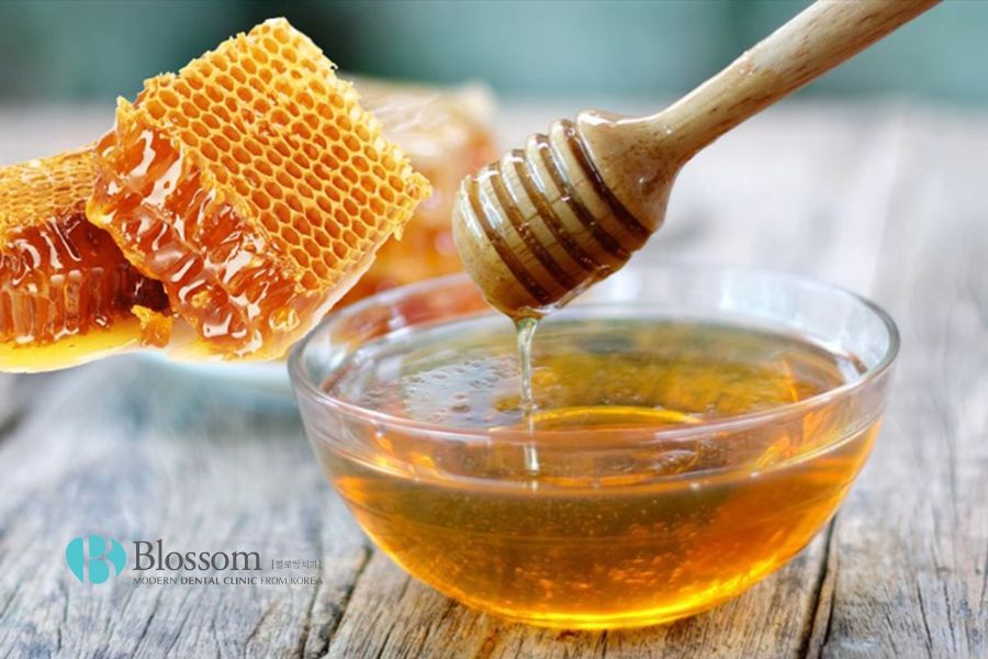 Mật ong có tính kháng khuẩn, sát khuẩn cao giúp làm giảm cơn đau ê buốt răng. 