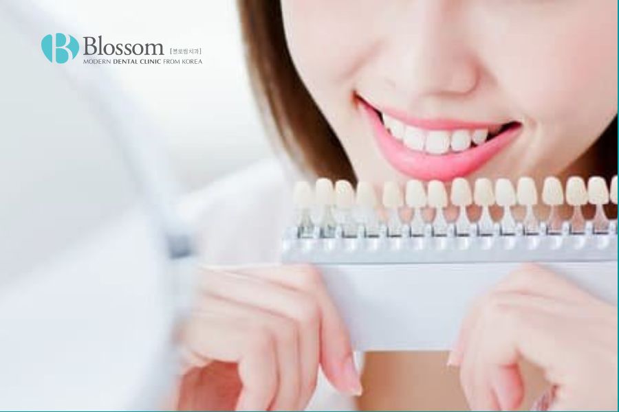 Cầu răng sứ là phương pháp giúp tiết kiệm thời gian và chi phí tối ưu.