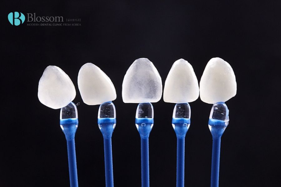 Chất lượng răng sứ với độ bền cao, tính thẩm mỹ tốt sẽ có giá cao hơn một số loại răng sứ khác