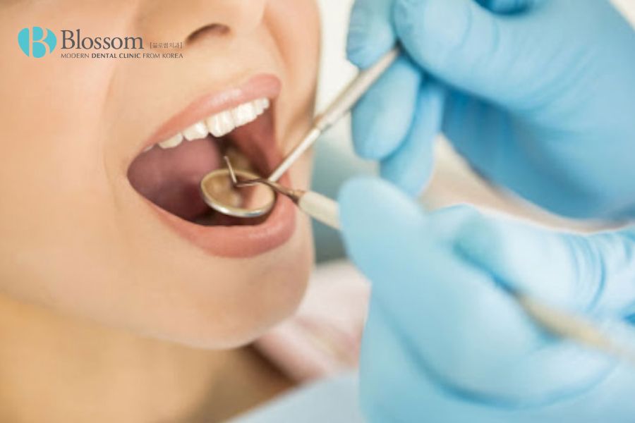 Nha khoa Blossom là địa chỉ tin cậy trong điều trị bệnh mòn cổ chân răng.