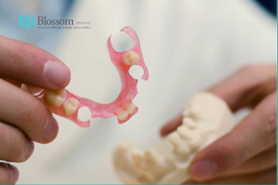 Răng giả tháo lắp là phương pháp tiết kiệm mang tính thẩm mỹ cao.