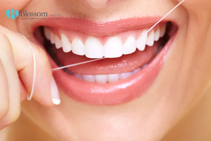Sau khi trám sâu răng cần chú ý vệ sinh răng miệng đúng cách
