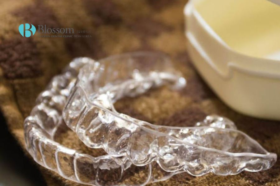 Sử dụng máng nhai giúp bảo vệ răng tốt hơn vào ban đêm.
