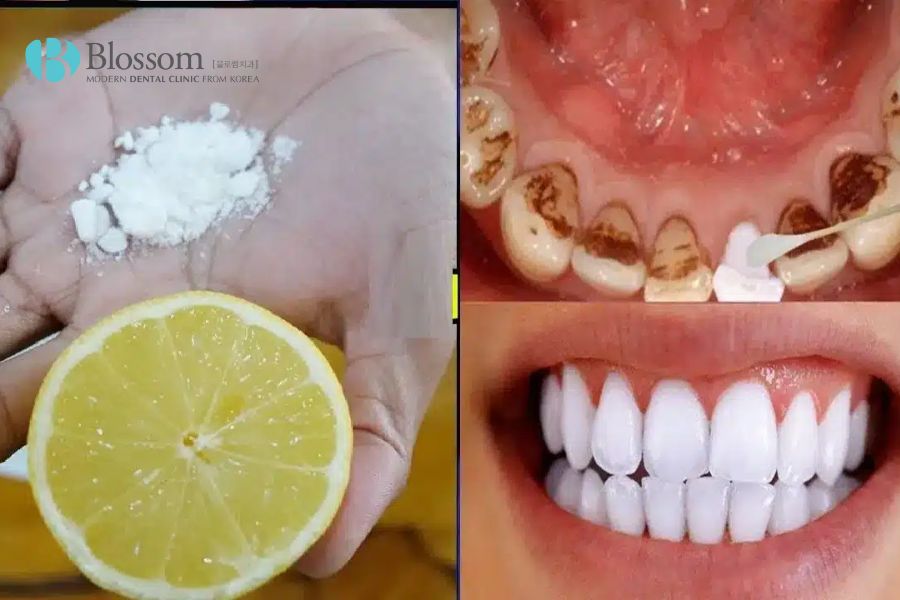 Sự kết hợp giữa muối và chanh mang lại hiệu quả làm trắng răng tuyệt vời.