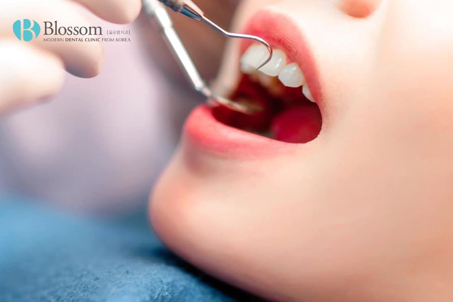 Thăm khám nha khoa định kỳ giúp kịp thời phát hiện chứng áp xe răng.