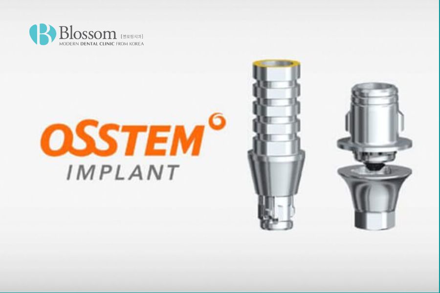 Trụ Implant Osstem được tin dùng bởi nha sĩ và bệnh nhân trên toàn thế giới.