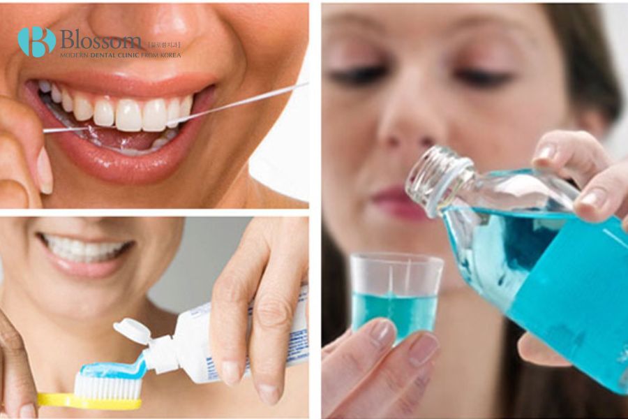 Vệ sinh răng miệng đúng cách giúp bao vệ răng.