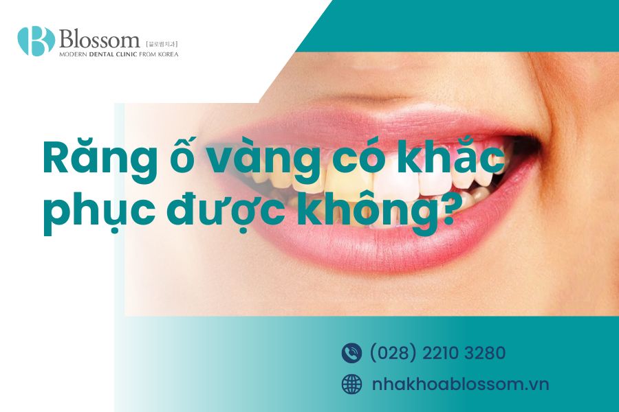 Vì sao răng bị ố vàng? Nguyên nhân và cách khắc phục như thế nào? – Nha Khoa Blossom