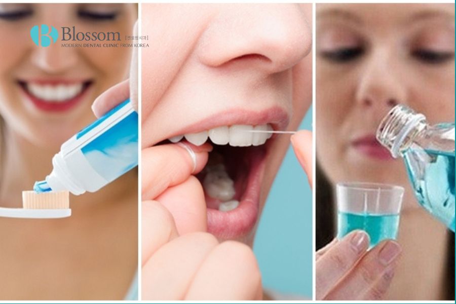 Việc chăm sóc răng miệng kỹ lưỡng sau khi làm cầu răng giúp duy trì kết quả lâu dài.