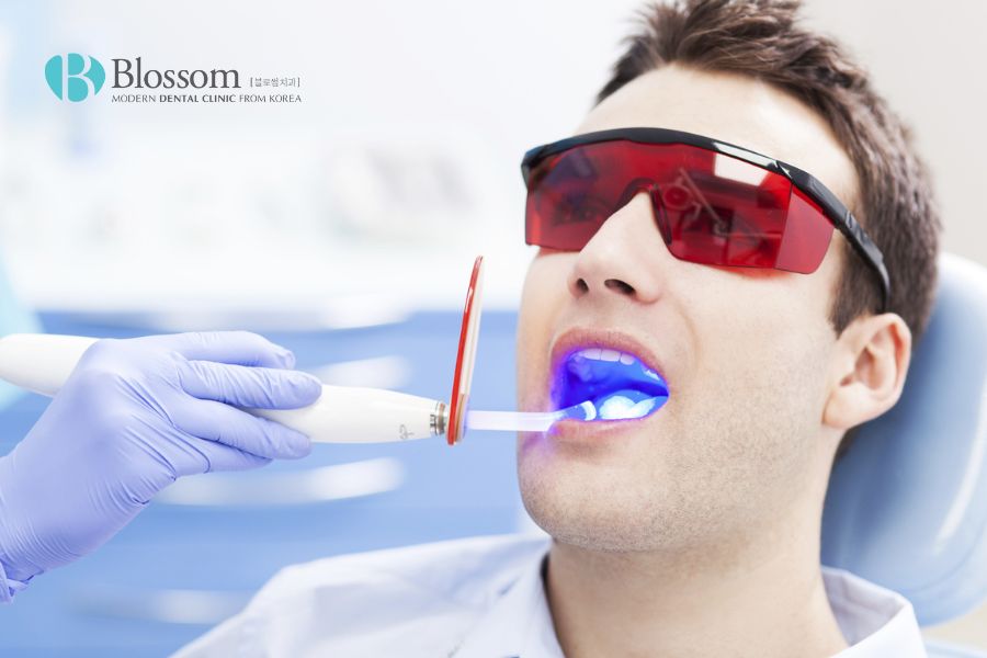Cách làm trắng răng bị ố vàng với đèn sinh học Led Bleaching System được đánh giá cao về hiệu quả.