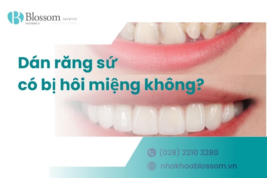 Dán răng sứ có bị hôi miệng không? Giải đáp từ chuyên gia