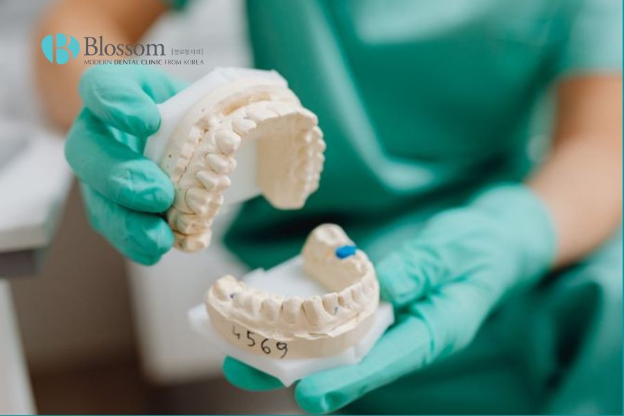 Lấy dấu răng giúp bác sĩ lưu trữ tình trạng răng và khớp cắn trước khi điều trị.