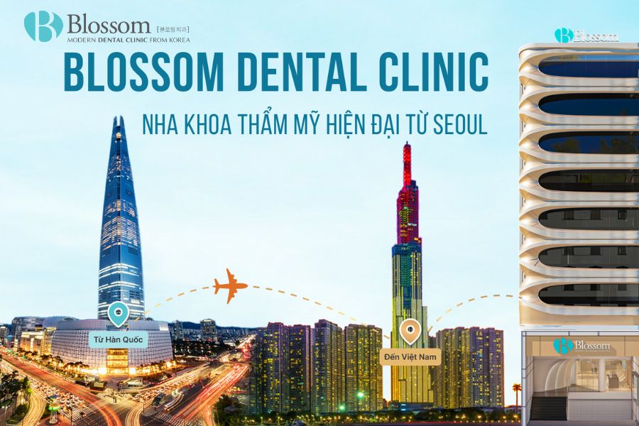 Nha khoa Blossom là địa chỉ uy tín giúp điều trị răng thưa.