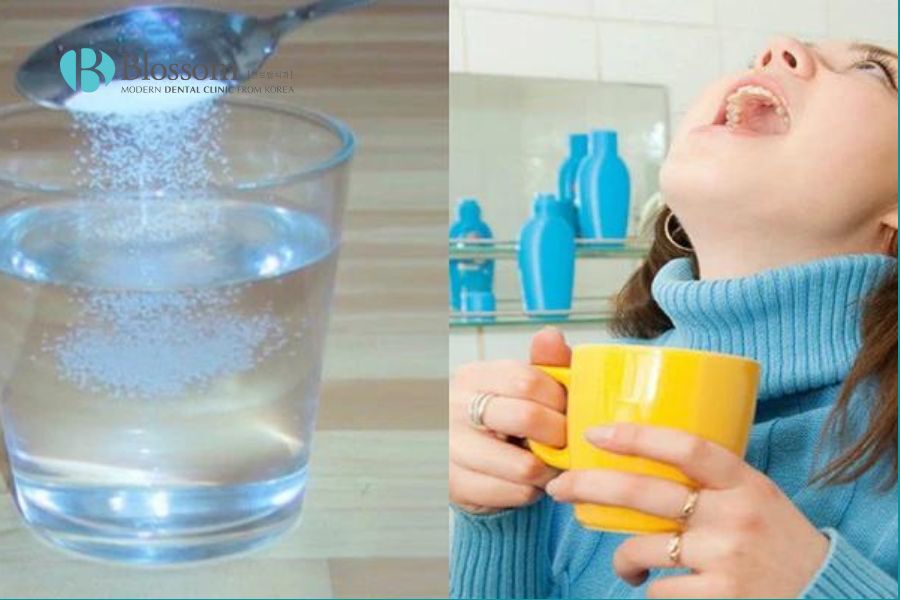 Nước muối sinh lý là một lựa chọn hiệu quả và tiết kiệm để giảm sưng viêm nướu.