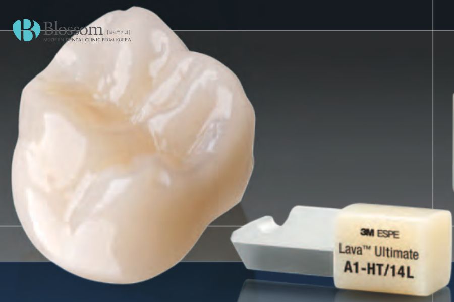 Răng sứ Lava Ultimate cho màu sắc trắng sáng, tự nhiên như răng thật