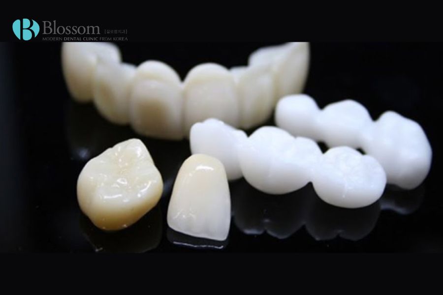Răng toàn sứ Multilayer Cercon HT mang đến màu sắc tự nhiên như răng thật