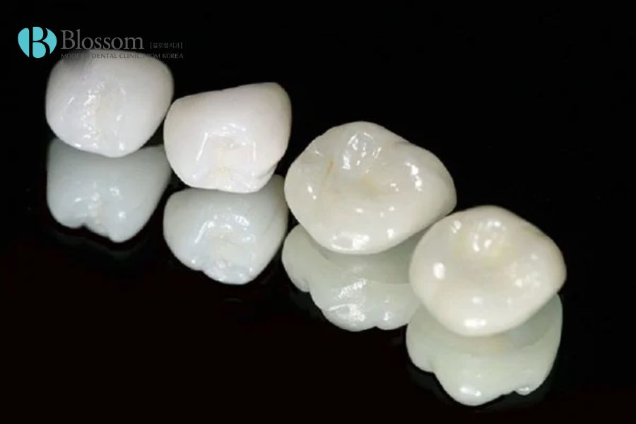 Răng toàn sứ Zirconia với độ bền vượt trội, có nguồn gốc từ Đức