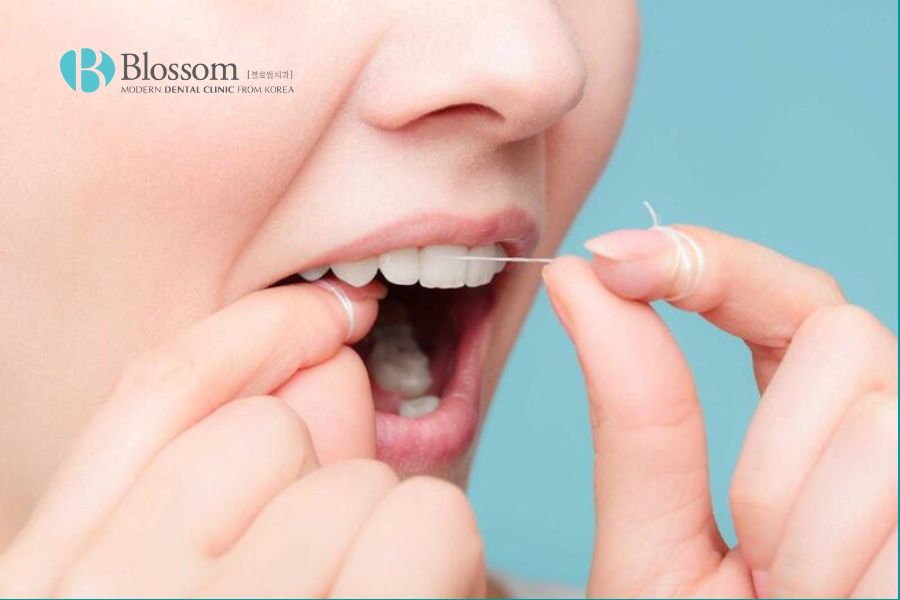 Sử dụng chỉ nha khoa giúp loại bỏ hoàn toàn mảng bám và thức ăn thừa giữa các kẽ răng.