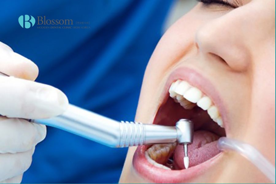 Thăm khám nha khoa định kỳ đóng vai trò quan trọng trong việc theo dõi tình trạng viêm nướu răng.