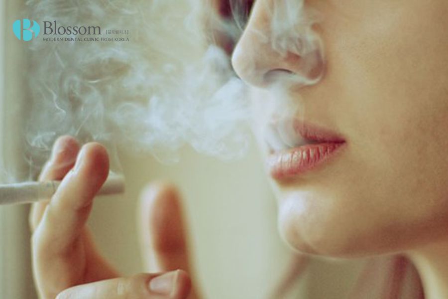 Thói quen hút thuốc lá dễ làm răng miệng có mùi hôi và gây xuất huyết chân răng.