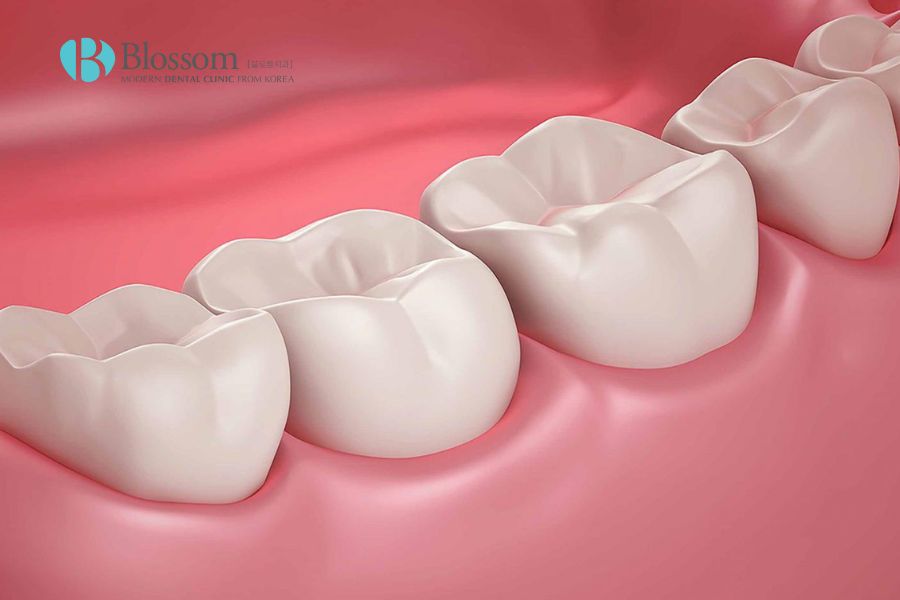 Vị trí mọc của răng hàm nhỏ là giữa răng nanh và răng hàm lớn.