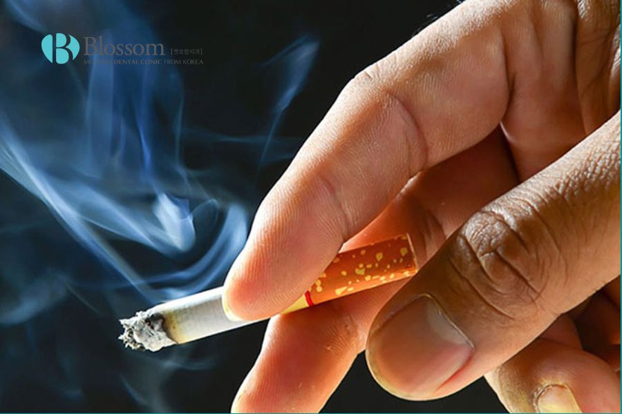 Việc sử dụng nicotin trong thuốc lá làm tăng nguy cơ tụt nướu.