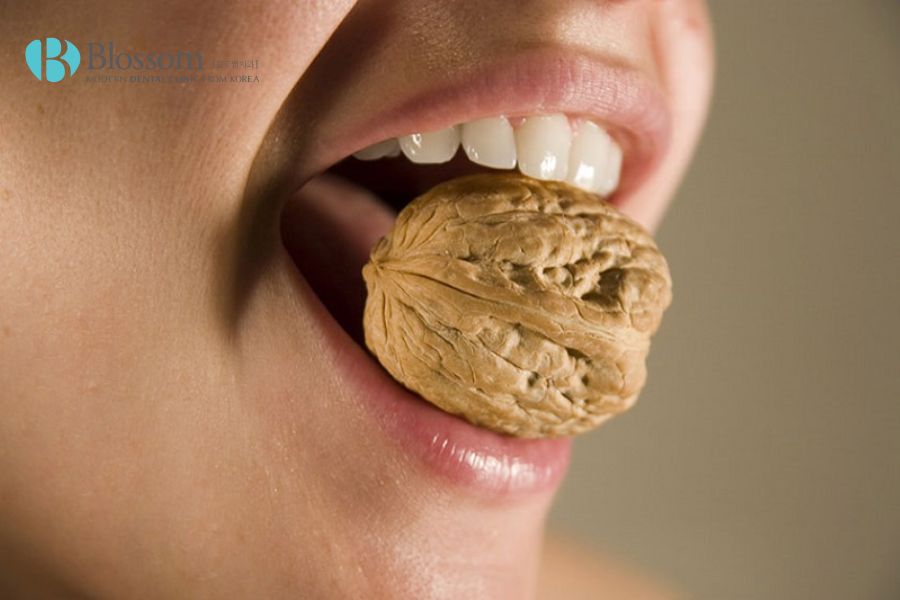 Ăn thực phẩm quá cứng cũng là nguyên nhân gây đau răng khi dán sứ