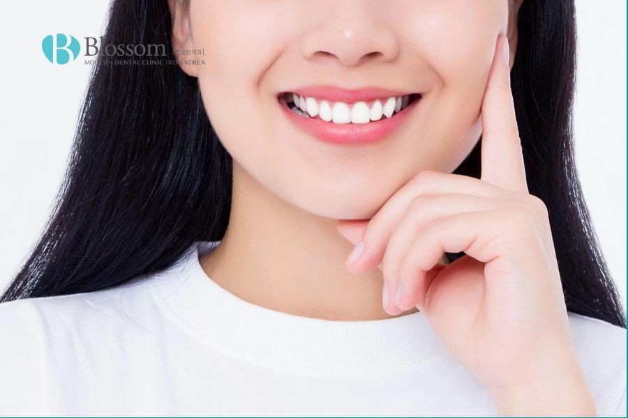 Bọc răng sứ phù hợp cho trường hợp răng bị nhiễm fluor nặng, ăn sâu vào ngà răng.