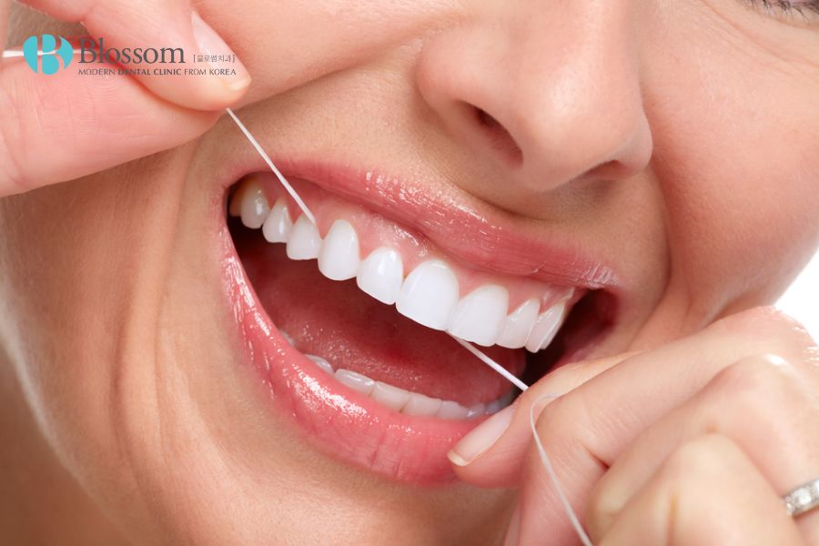 Chăm sóc răng miệng cẩn thận là một trong những yếu tố tác động tích cực đến tuổi thọ mặt dán sứ