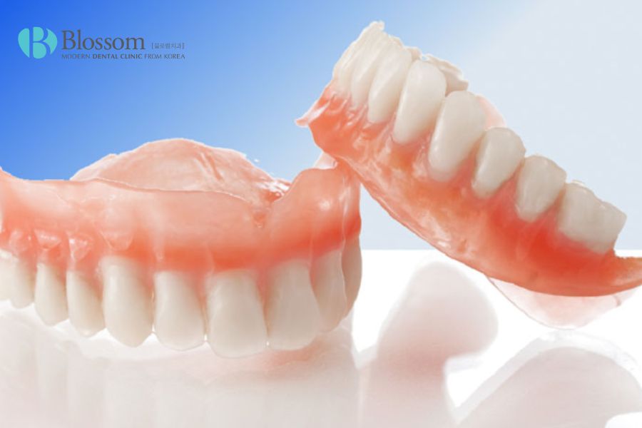 Hàm răng giả tháo lắp là giải pháp tối ưu cho trường hợp mất nhiều răng hoặc toàn hàm