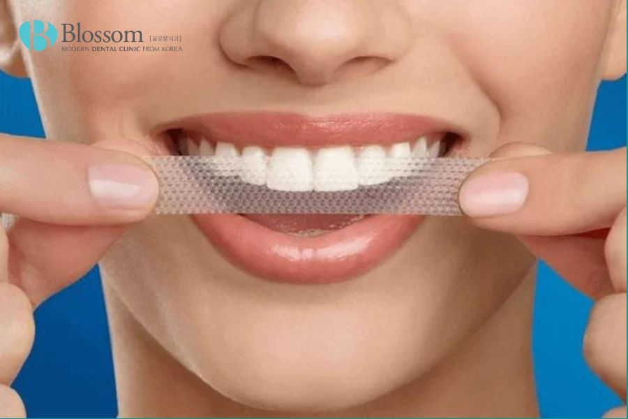 Kết hợp sử dụng miếng dán trắng răng sẽ giúp bạn đạt được hiệu quả tối ưu, giảm thiểu cao răng