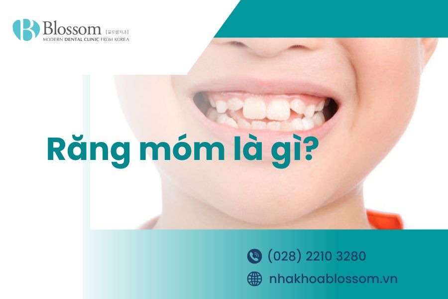 Răng móm là gì? Nguyên nhân và cách điều trị răng móm