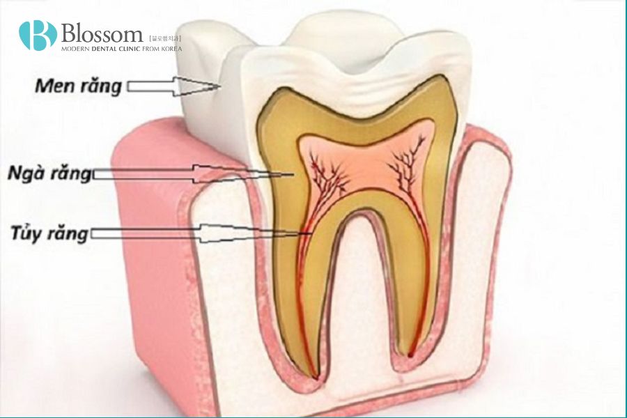 Răng nanh có cấu trúc gồm 3 phần chính: men răng, ngà răng và tủy răng.