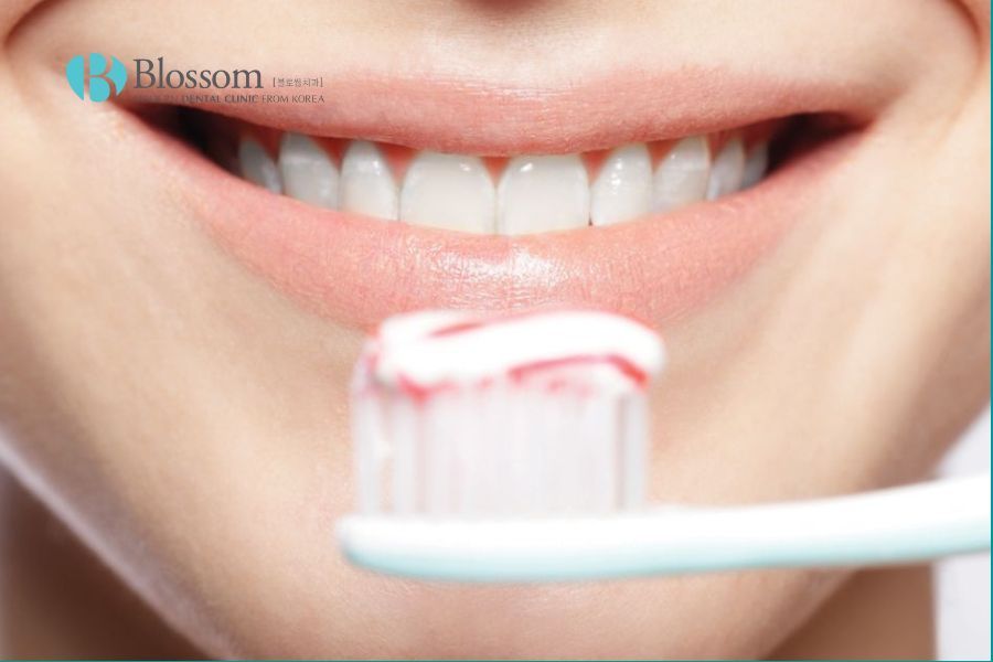 Sau khi gắn mão răng trên Implant bạn nên tái khám định kỳ 6 tháng/lần.