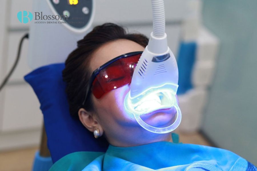 Tẩy trắng răng với đèn Plasma được nhiều người lựa chọn khi có nhu cầu thẩm mỹ răng trắng sáng, nhanh gọn.