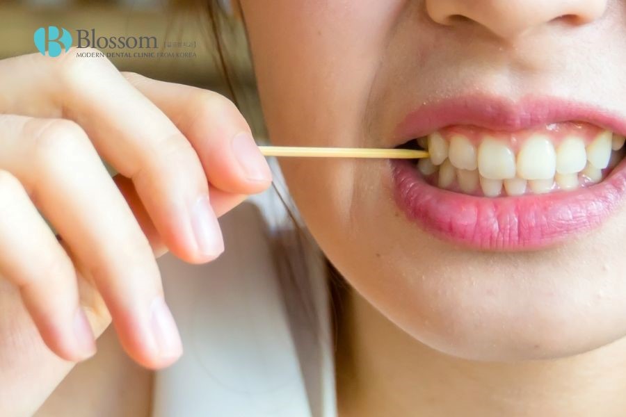 Thói quen dùng tăm xỉa răng dễ khiến răng bị thưa.