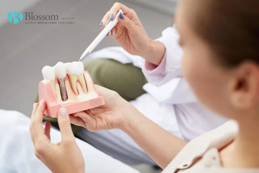Thực hiện cấy ghép Implant tại những nha khoa không uy tín thường ảnh hưởng tiêu cực đến tuổi thọ của răng