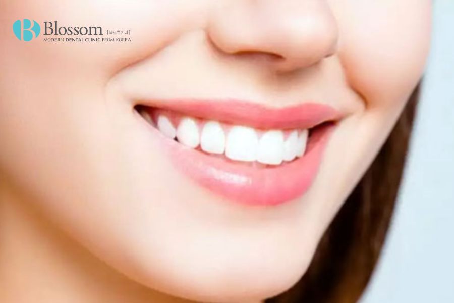 Trồng răng giả mang lại nhiều lợi ích như cải thiện chức năng ăn nhai, thẩm mỹ,...