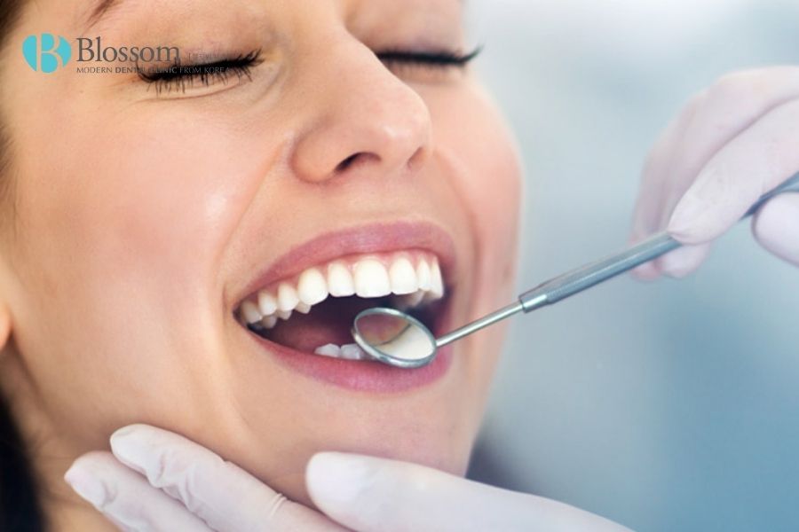 Việc sát khuẩn, vệ sinh răng miệng đóng vai trò quan trọng trước khi dán sứ