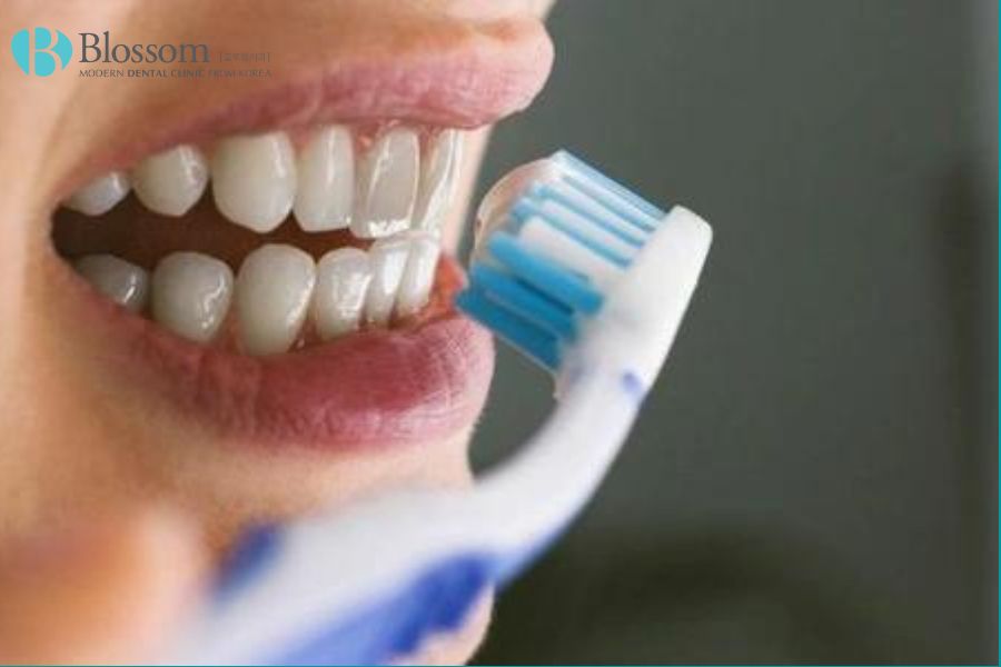 Việc vệ sinh răng miệng kém khiến thức ăn thừa và mảng bám tích tụ trên răng.
