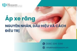Nguyên nhân – dấu hiệu và cách điều trị áp xe răng