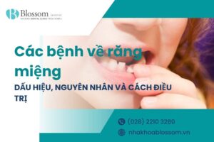 Đâu là các bệnh về răng miệng thường gặp nhất hiện nay?