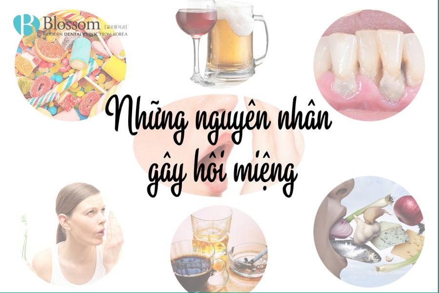 Nguyên nhân gây hôi miệng. Cách trị hôi miệng hiệu quả tại nhà 2 cach tri hoi mieng tai nha 1