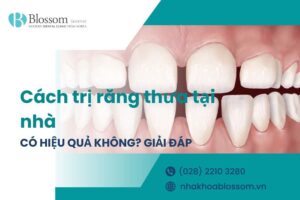 Cách trị răng thưa tại nhà liệu có hiệu quả? Làm thế nào để răng khít lại?