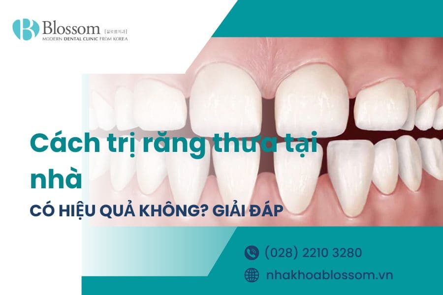Cách trị răng thưa tại nhà liệu có hiệu quả? Làm thế nào để răng khít lại?