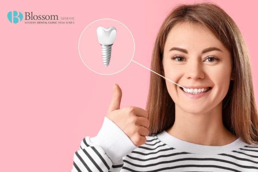 Cấy ghép Implant là gì? Những thông tin cần biết 11 cay ghep implant 10